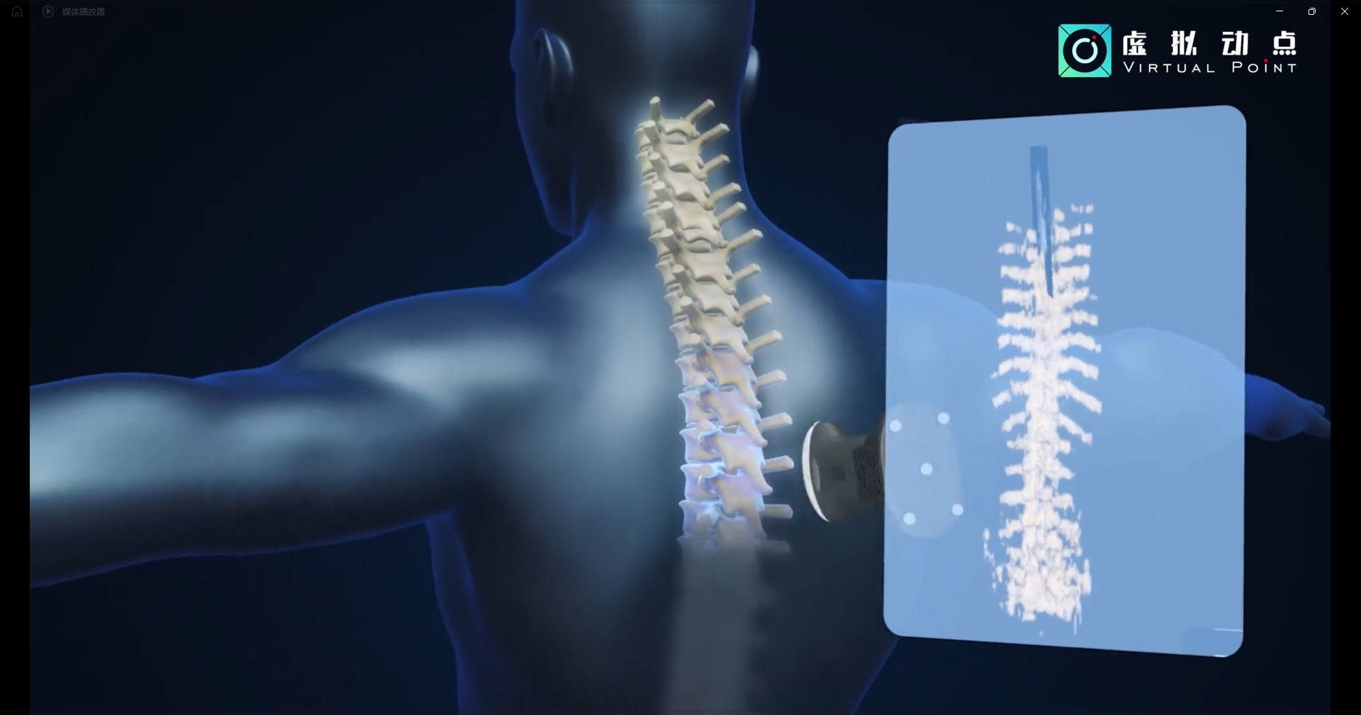 今年会·(jinnianhui)金字招牌诚信·虚拟动点OptiTrack开创3D超声成像在脊柱诊断中的应用